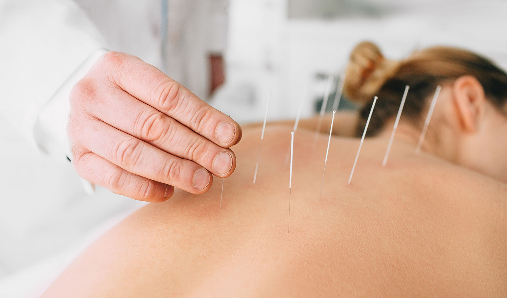Enhance Your Recovery with Acupuncture at Wish Recovery